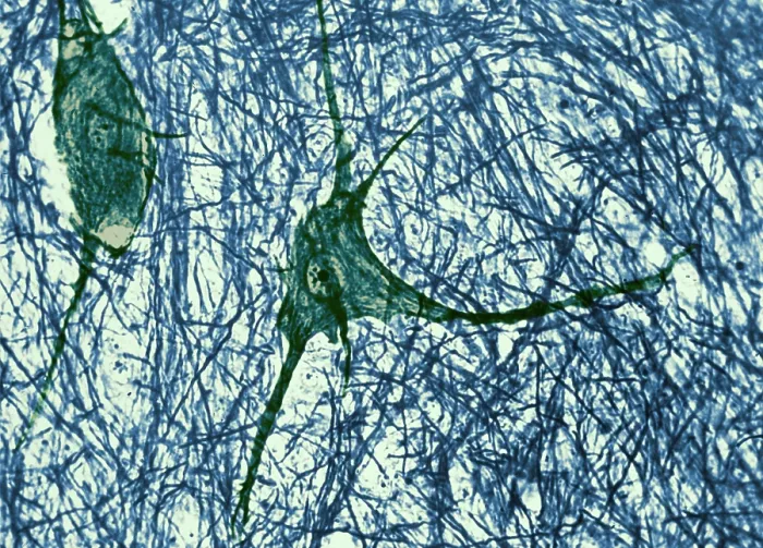 Framed Print : Motor Neuron, TEM Framed Print : Motor Neuron, TEM