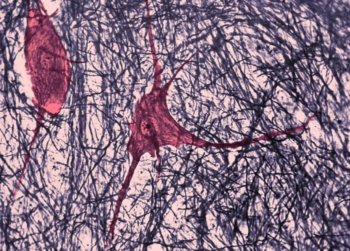Framed Print : Motor Neuron, TEM Framed Print : Motor Neuron, TEM