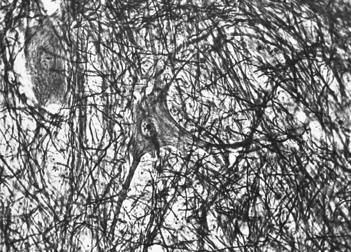 Framed Print : Motor Neuron, TEM