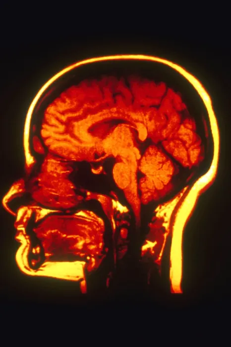 Framed Print : MRI of Head Framed Print : MRI of Head