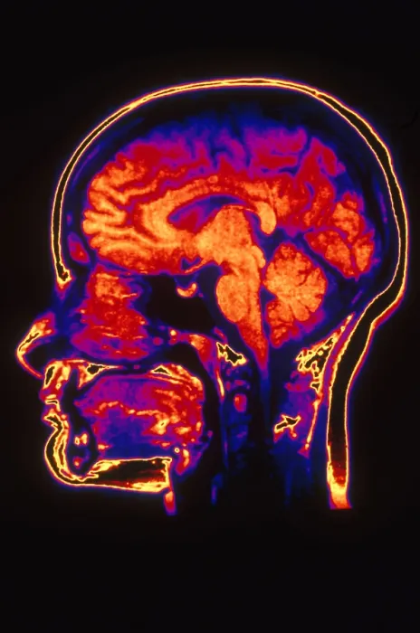 Framed Print : MRI of Head Framed Print : MRI of Head