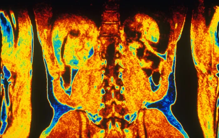 Framed Print : MRI of Human Torso Framed Print : MRI of Human Torso