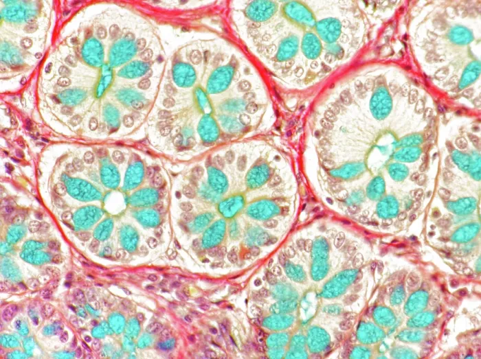Framed Print : Mucus glands, rectum, light micrograph