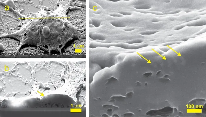 Framed Print : Nanoparticles, Neural Cell, SHIM Framed Print : Nanoparticles, Neural Cell, SHIM