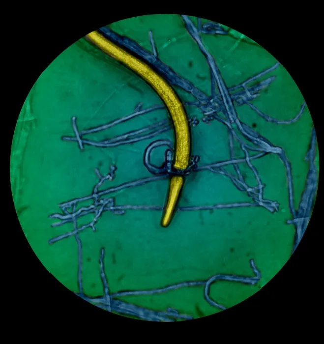 Framed Print : Nematode Snared by Predatory Fungus (LM) under a microscope Framed Print : Nematode Snared by Predatory Fungus (LM) under a microscope