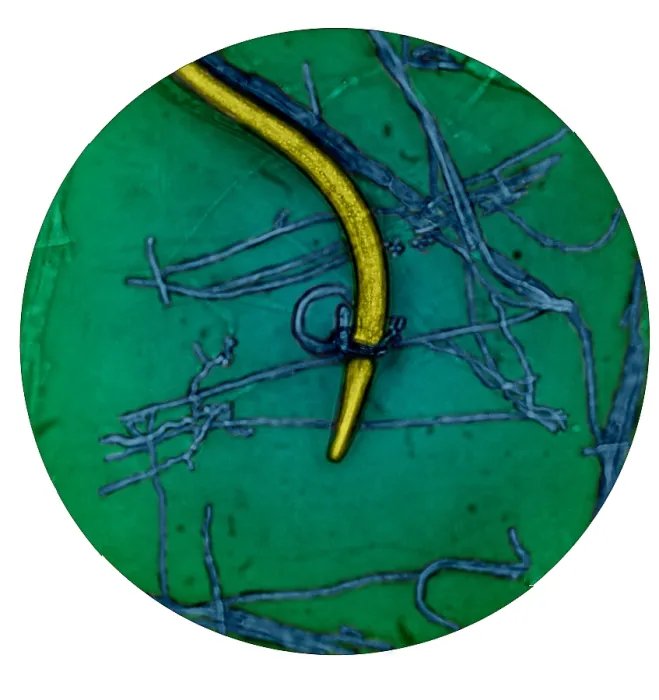 Framed Print : Nematode Snared by Predatory Fungus (LM) under a microscope