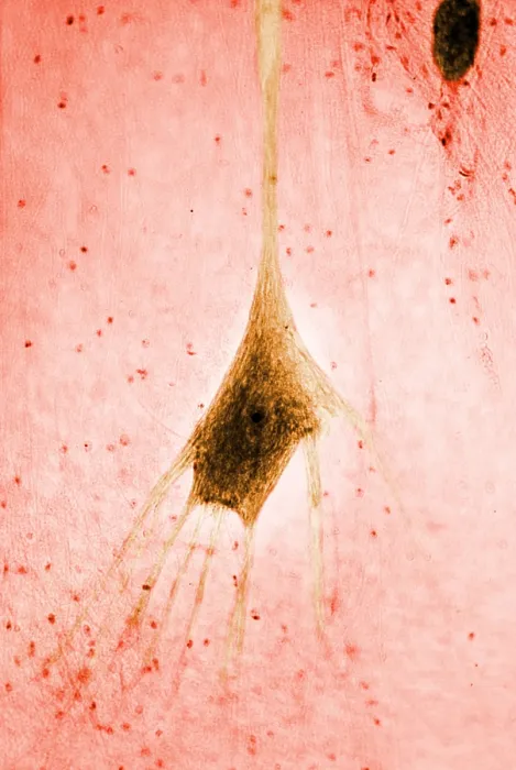 Framed Print : Nervous System, Human Neuron, light micrograph Framed Print : Nervous System, Human Neuron, light micrograph