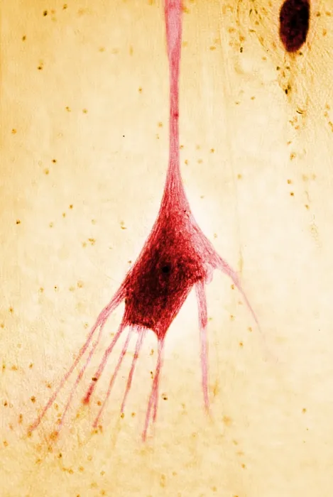 Framed Print : Nervous System, Human Neuron, light micrograph Framed Print : Nervous System, Human Neuron, light micrograph