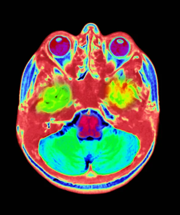 Framed Print : Normal MRI Framed Print : Normal MRI