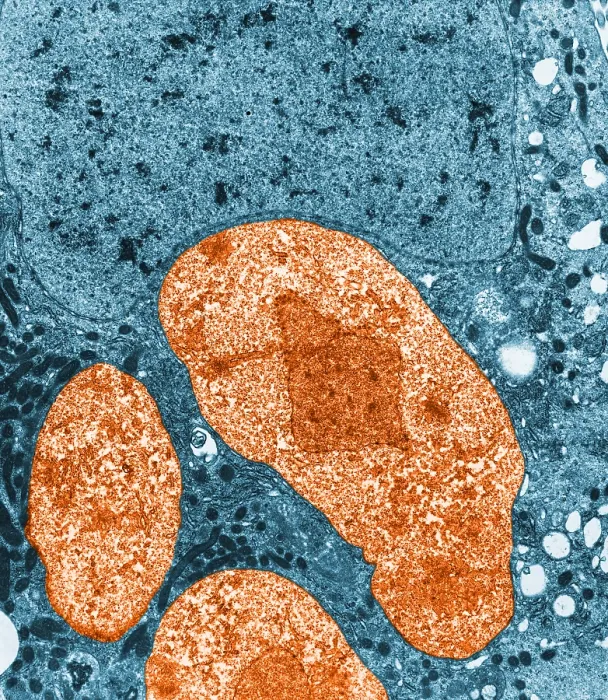 Framed Print : Nosema apis (TEM) Framed Print : Nosema apis (TEM)