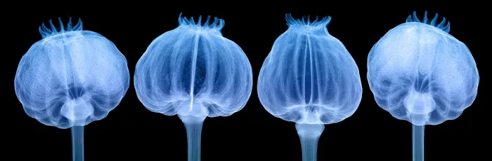 Framed Print : Opium Poppy Pods, X-ray Framed Print : Opium Poppy Pods, X-ray