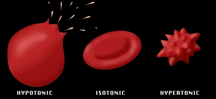 Framed Print : Osmotic Pressure on Blood Cells