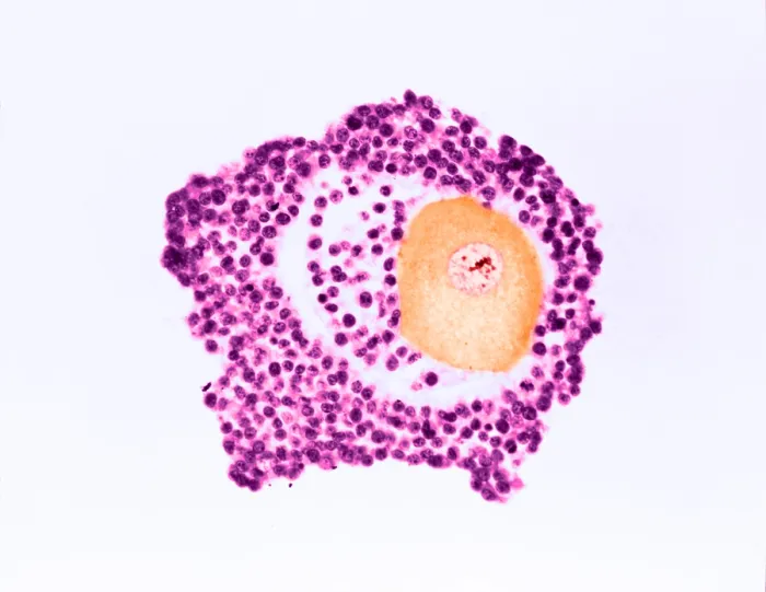 Framed Print : Ovarian egg Framed Print : Ovarian egg