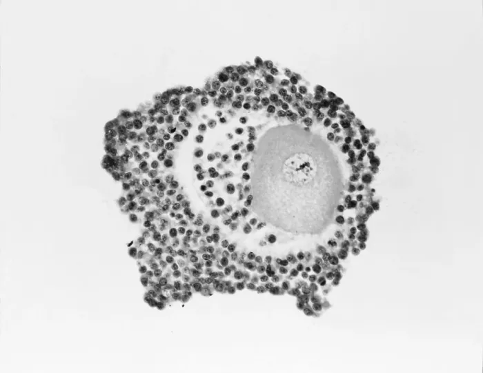 Framed Print : Ovarian egg