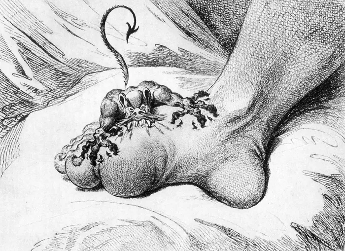 Framed Print : The Pain of Gout, 1799