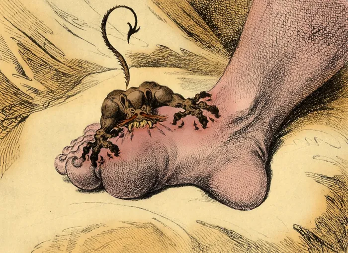 Framed Print : The Pain of Gout, 1799 Framed Print : The Pain of Gout, 1799