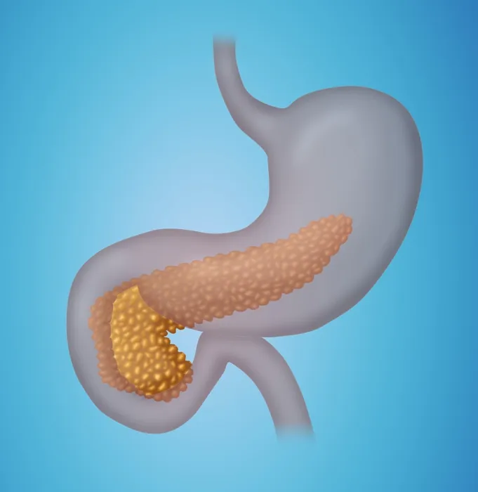 Framed Print : Pancreas. Illustration of a human pancreas within the stomach