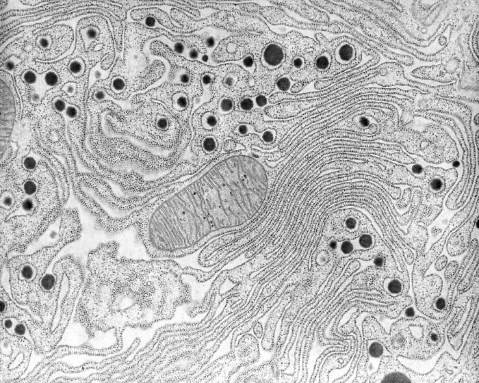 Framed Print : Pancreas, Endoplasmic Reticulum, TEM Framed Print : Pancreas, Endoplasmic Reticulum, TEM