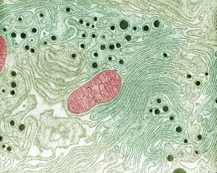 Framed Print : Pancreas, Endoplasmic Reticulum, TEM