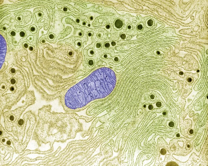 Framed Print : Pancreas, Endoplasmic Reticulum, TEM
