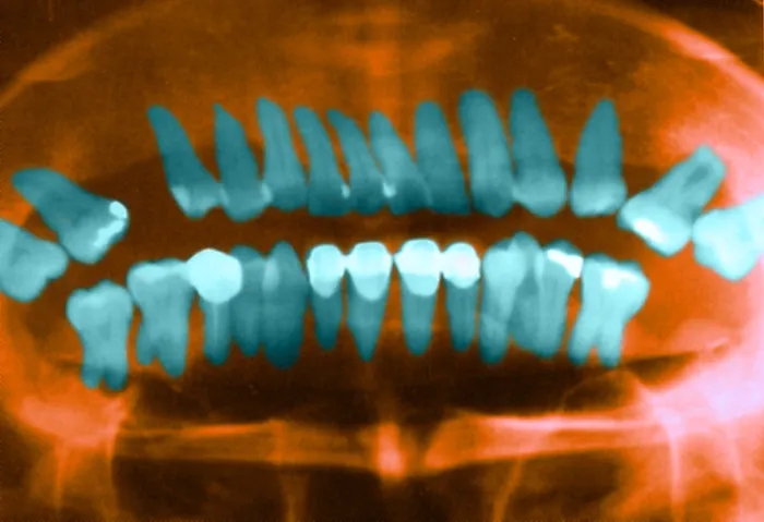 Framed Print : Panoramic Dental X-Ray Framed Print : Panoramic Dental X-Ray