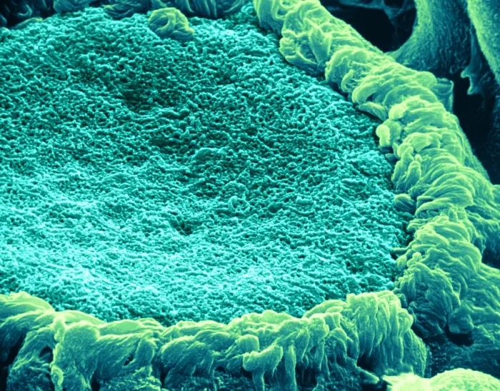 Framed Print : Papilla of frog's tongue, under a microscope (SEM) Framed Print : Papilla of frog's tongue, under a microscope (SEM)