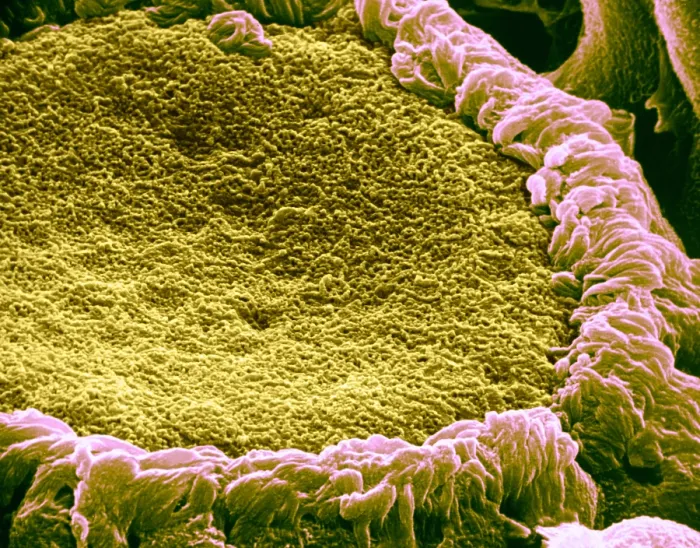 Framed Print : Papilla of frog's tongue, under a microscope (SEM) Framed Print : Papilla of frog's tongue, under a microscope (SEM)
