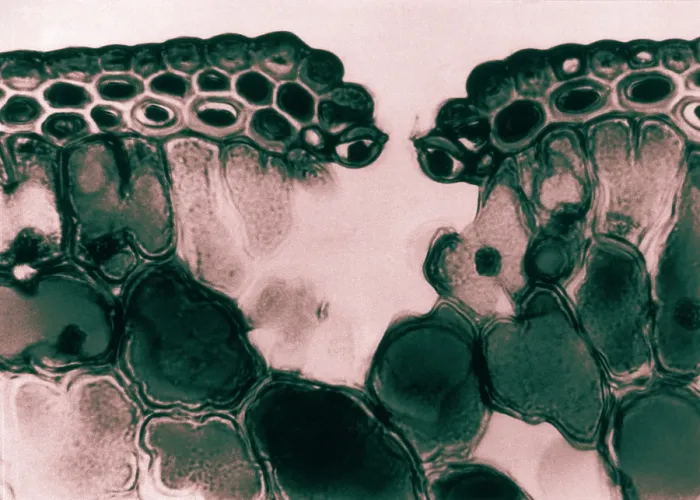 Framed Print : Pine Leaf Cuticle and Epidermal Cells, light micrograph Framed Print : Pine Leaf Cuticle and Epidermal Cells, light micrograph