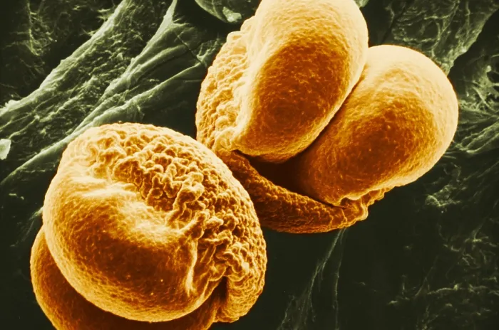 Framed Print : Pine Pollen, under a microscope (SEM) Framed Print : Pine Pollen, under a microscope (SEM)