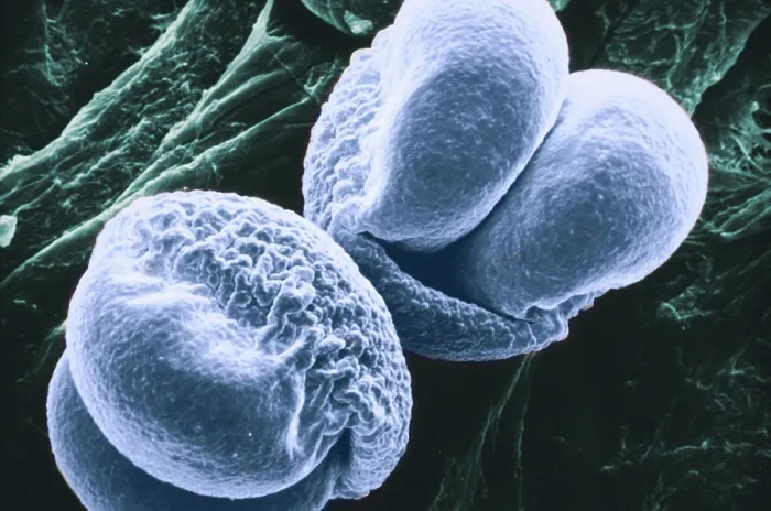 Framed Print : Pine Pollen, under a microscope (SEM)