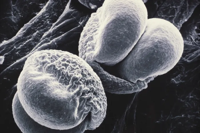 Framed Print : Pine Pollen (SEM) Framed Print : Pine Pollen (SEM)