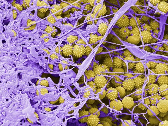 Framed Print : Pollen Grains with Fungal Growth, scanning electron micrograph Framed Print : Pollen Grains with Fungal Growth, scanning electron micrograph