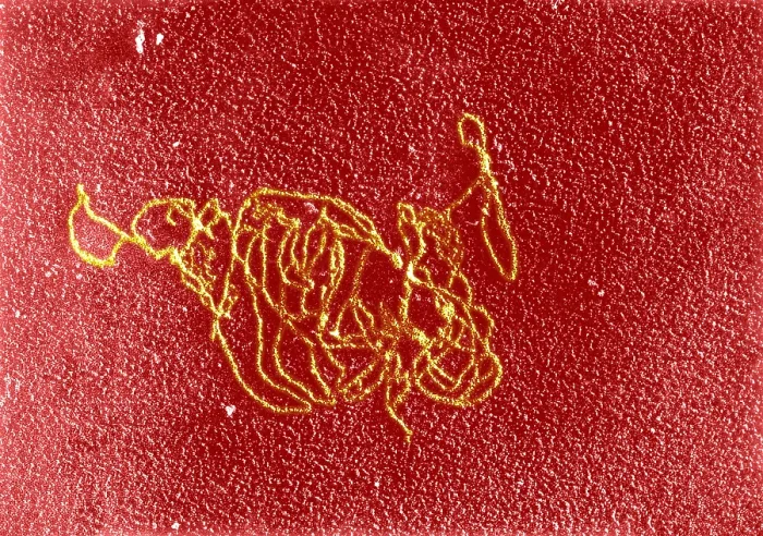 Framed Print : Polymerase Reaction, DNA with E. coli RNA, TEM