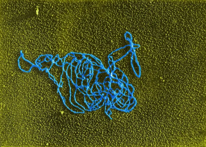 Framed Print : Polymerase Reaction, DNA with E. coli RNA, TEM