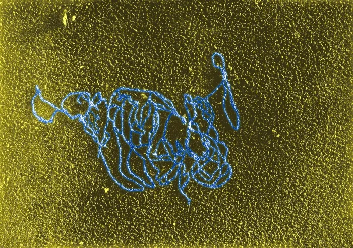 Framed Print : Polymerase Reaction, DNA with E. coli RNA, TEM Framed Print : Polymerase Reaction, DNA with E. coli RNA, TEM