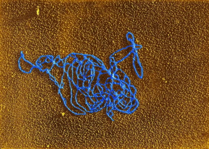 Framed Print : Polymerase Reaction, DNA with E. coli RNA, TEM
