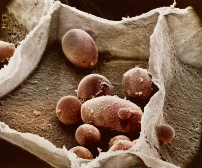 Framed Print : Potato cell with starch granules Framed Print : Potato cell with starch granules