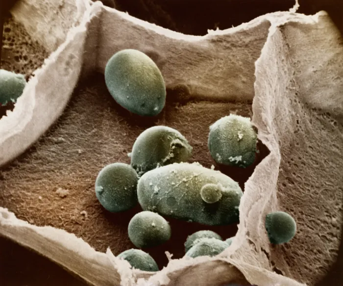 Framed Print : Potato cell with starch granules Framed Print : Potato cell with starch granules