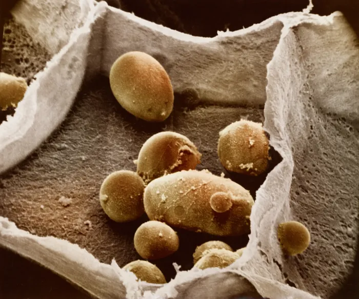 Framed Print : Potato cell with starch granules Framed Print : Potato cell with starch granules