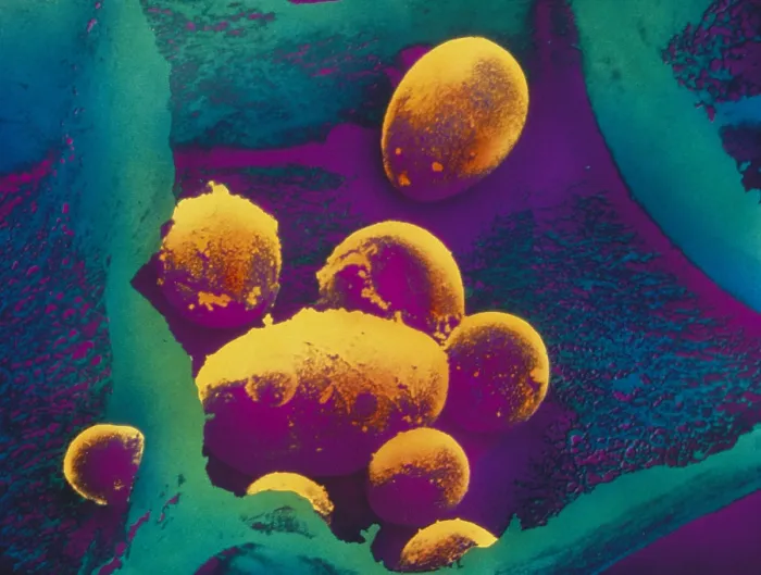 Framed Print : Potato Starch in Plastid SEM