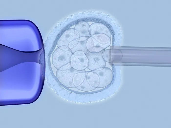 Framed Print : Preimplantation genetic diagnosis
