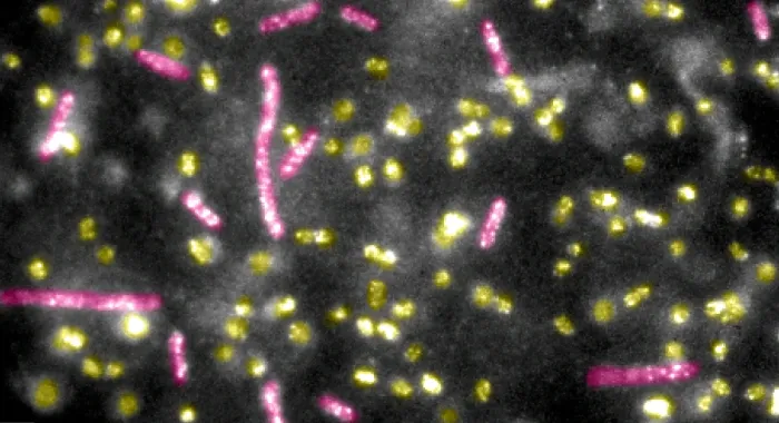 Framed Print : Quantum Dots bound to E.coli Bacteria Framed Print : Quantum Dots bound to E.coli Bacteria