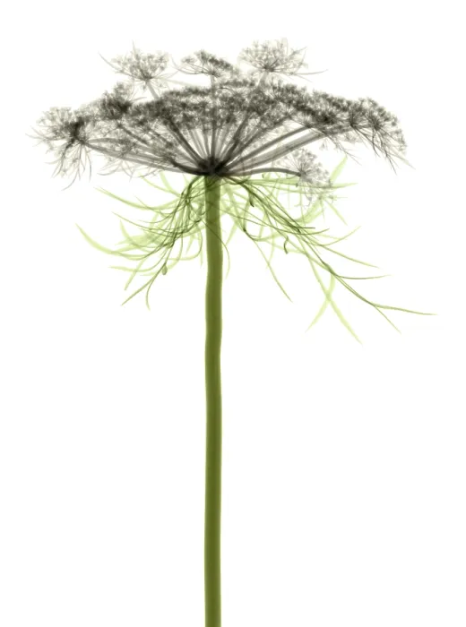 Framed Print : Queen Anne's Lace, X-ray Framed Print : Queen Anne's Lace, X-ray