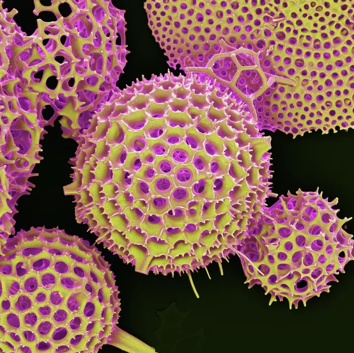 Framed Print : Radiolarian, scanning electron micrograph Framed Print : Radiolarian, scanning electron micrograph