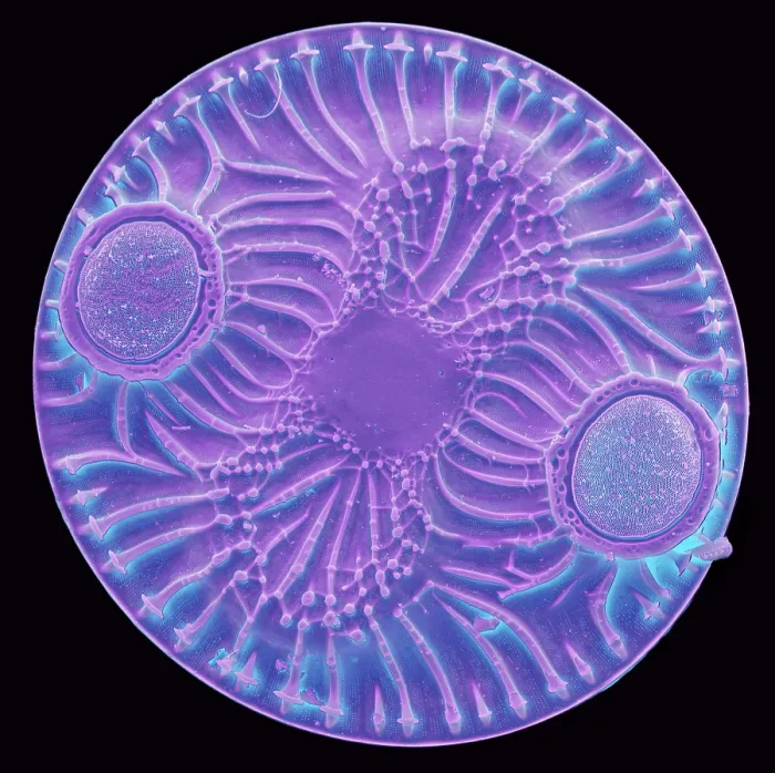 Framed Print : Radiolarian, scanning electron micrograph Framed Print : Radiolarian, scanning electron micrograph