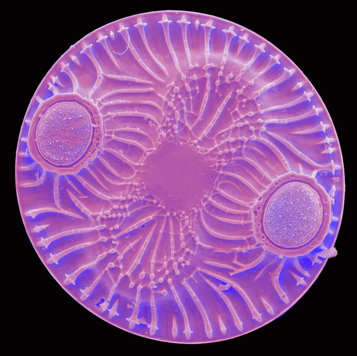 Framed Print : Radiolarian, scanning electron micrograph Framed Print : Radiolarian, scanning electron micrograph