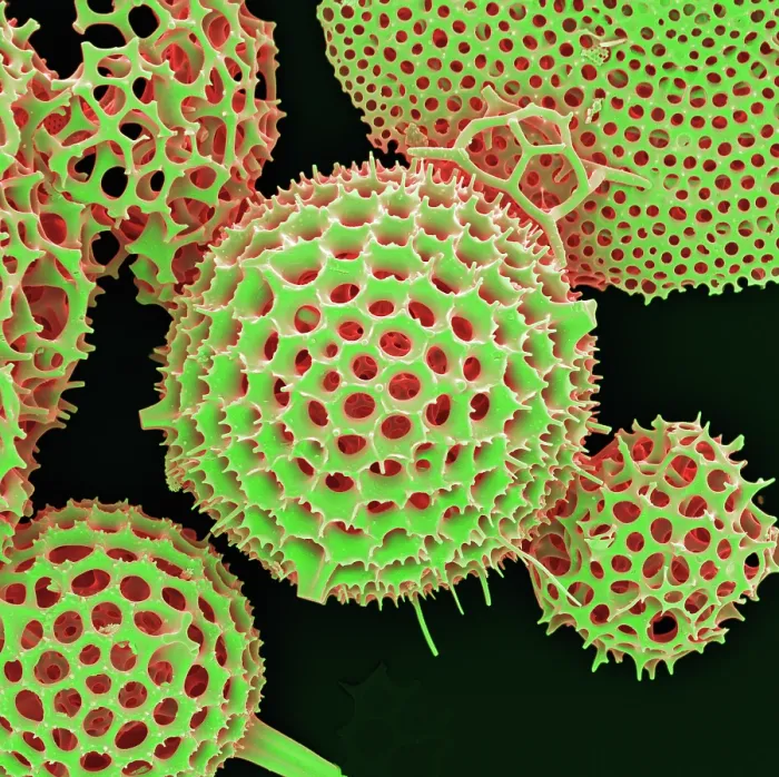 Framed Print : Radiolarian, scanning electron micrograph Framed Print : Radiolarian, scanning electron micrograph