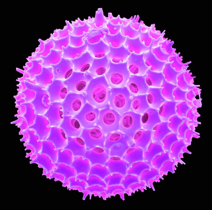 Framed Print : Radiolarian, scanning electron micrograph Framed Print : Radiolarian, scanning electron micrograph