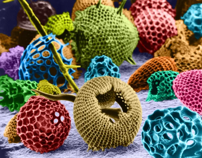 Framed Print : Radiolarians (SEM) Framed Print : Radiolarians (SEM)