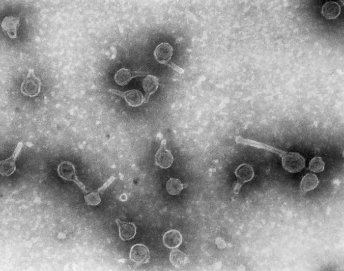 Framed Print : Rauscher Leukemia Virus Framed Print : Rauscher Leukemia Virus